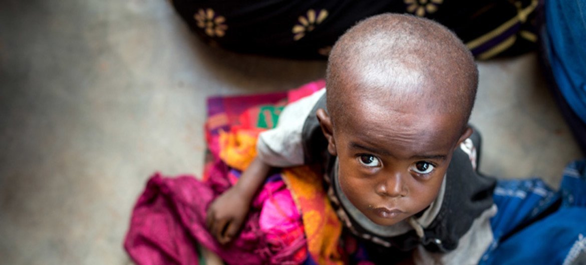 Un enfant souffrant de malnutrition attend d'être soigné dans un centre de santé dans la province du Kasaï oriental en République démocratique du Congo - une région en proie à un conflit entre la milice du chef traditionnel Kamuina Nsapu et les forces armées gouvernementales. © UNICEF / UN064921