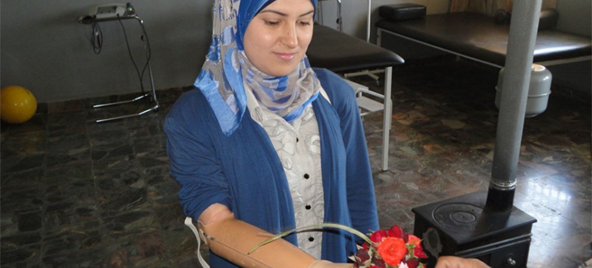 Karima suffered an above-elbow amputation since an early age. With the prosthesis, Karima is now employed with the Lebanese Physically Handicapped Union.