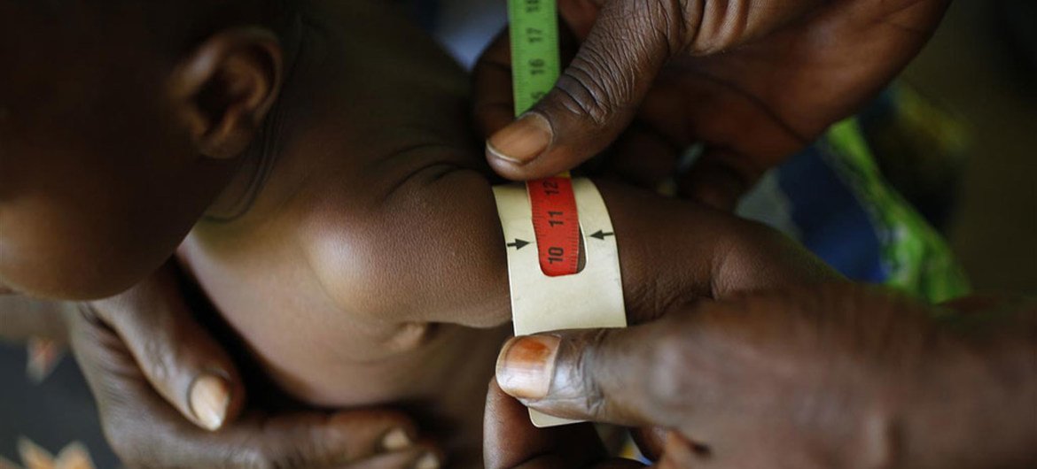 Un bébé a la circonférence du milieu de son bras supérieur gauche mesuré pour des signes de malnutrition. 