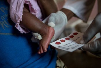 刚果民主共和国一名婴儿正在接受HIV检查。