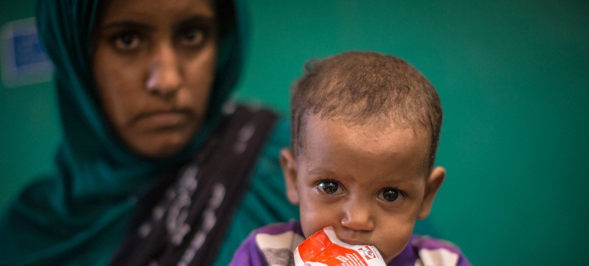 马里的加奥（Gao）地区的一家医院内，一岁的马卡（Marka）坐在母亲的腿上。马卡患有急性重症营养不良，并伴有并发症。