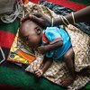 在尼日尔东南部迪法市（Diffa）的一家母婴中心，一名营养不良的幼儿正在熟睡，母亲正抚摸着他的头。