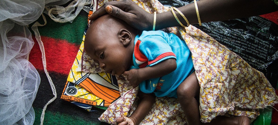 在尼日尔东南部迪法市（Diffa）的一家母婴中心，一名营养不良的幼儿正在熟睡，母亲正抚摸着他的头。