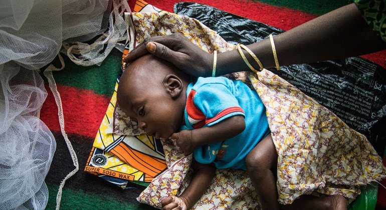 Afrika Boynuzu: 5 yaşın altındaki 7 milyondan fazla çocuk yetersiz besleniyor

 Nguncel.com
