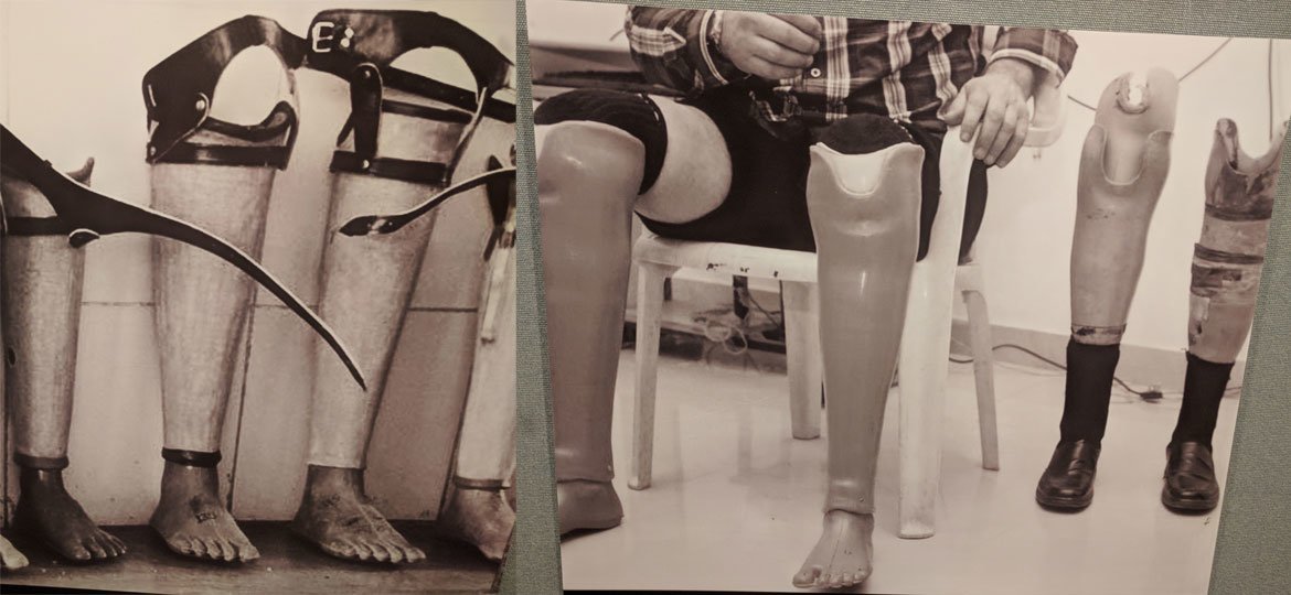 在联合国纽约总部举行的“斋浦尔义肢之旅”展览上出展的有关义肢的图片。