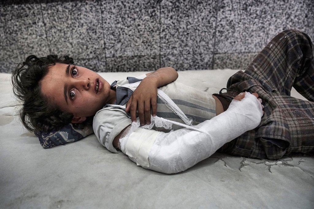 أرشيف: طفل يمني بانتظار العلاج في غرفة الطوارئ بمستشفى الجمهوري في صنعاء، اليمن. 3 مايو/أيار 2017.