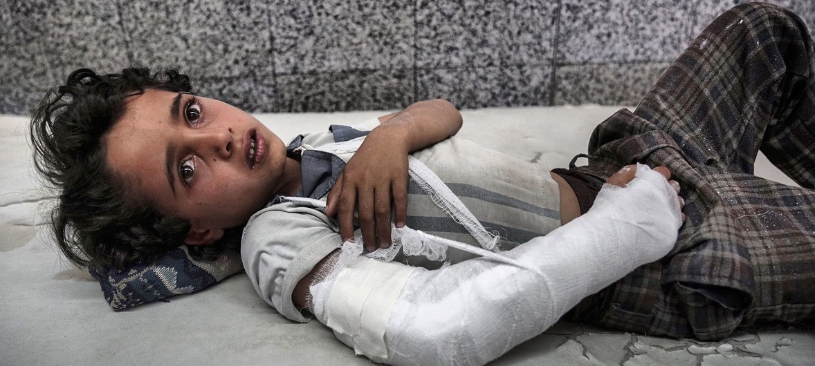 أرشيف: طفل يمني بانتظار العلاج في غرفة الطوارئ بمستشفى الجمهوري في صنعاء، اليمن. 3 مايو/أيار 2017.