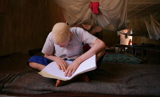 Criança que vive com albinismo lendo livro. 