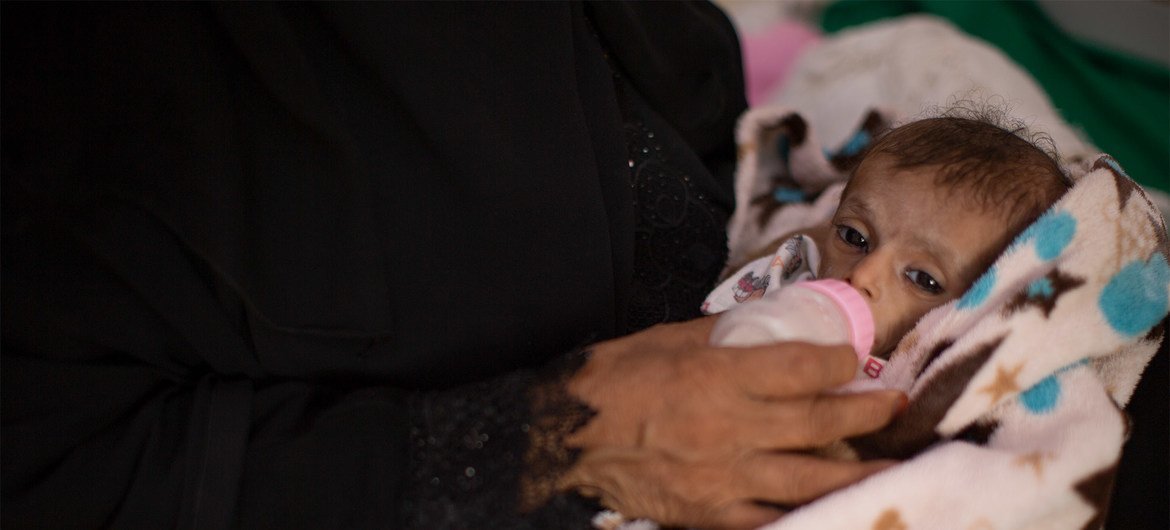 Абдулрахамману Ясеру из Йемена шесть месяцев. Он весит  2,8 кг и страдает от острой формы истощения.  