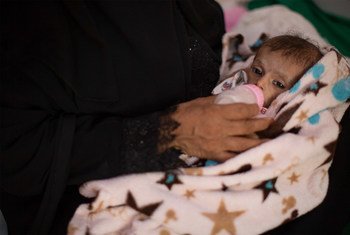 عبد الرحمن، البالغ من العمر 6 أشهر، يعاني من سوء تغذية حاد. يزن عبد الرحمن 2.8 كيلو غرام. يتلقى عبد الرحمن العلاج في مستشفى الصدقة في عدن، اليمن. 15 أغسطس/آب 2018.