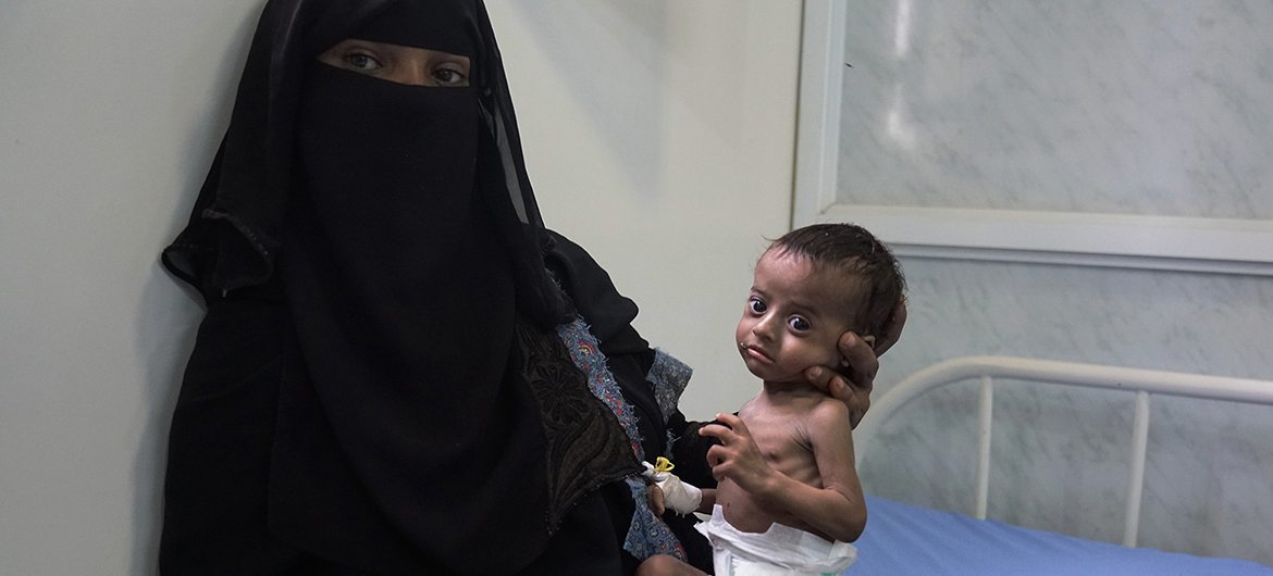 Saleh, âgé de quatre mois, admis dans le principal hôpital d'Hodeïda, avec sa mère Nora, en 2017. Des millions de personnes au Yémen sont menacées par la faim.