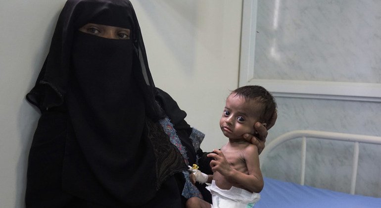 Saleh, de cuatro meses de edad, ingresado en el principal hospital de Al Hudaydah en abril de 2017, y su madre, Nora. Cerca de dos millones de madres en Yemen corren el riesgo de morir de desnutrición aguda grave debido al 