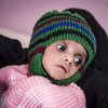 Un enfant souffrant de malnutrition est soigné à l'hôpital Al Sabeen, à Sana'a, au Yémen.