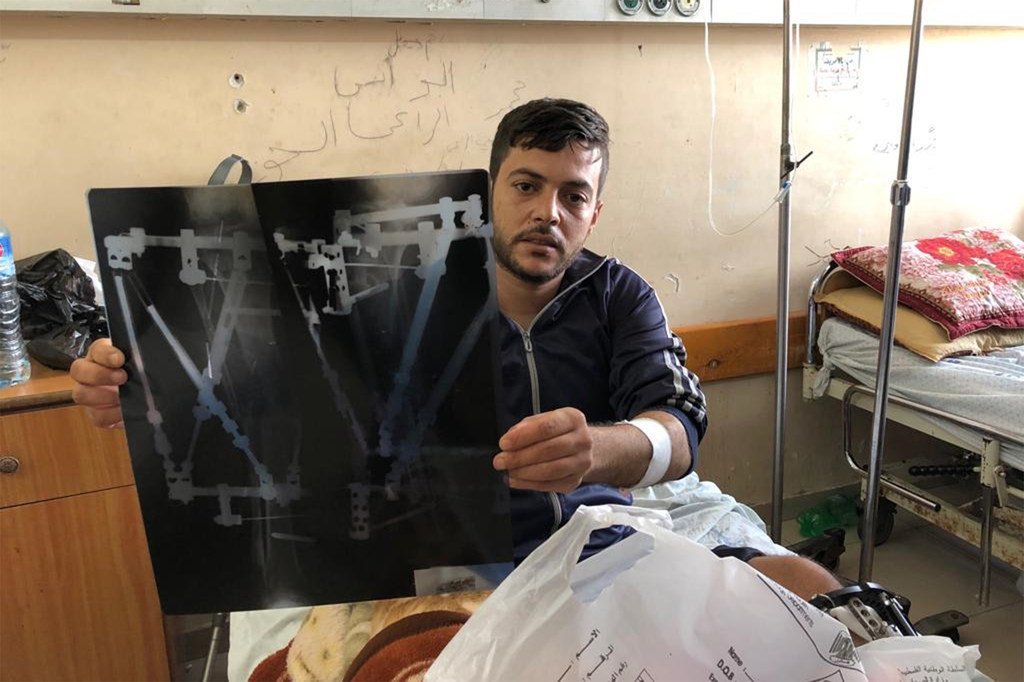 أحد المصابين في مستشفى الشفاء بغزة.