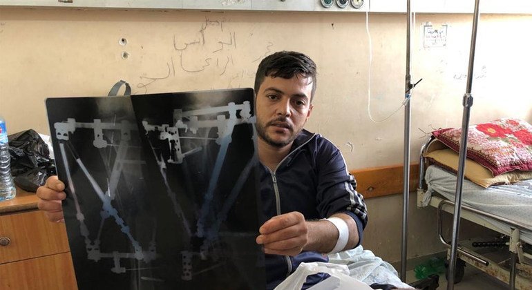 Mahmoud, an injured Palestinian at Al-Shifa Hospital in Gaza.