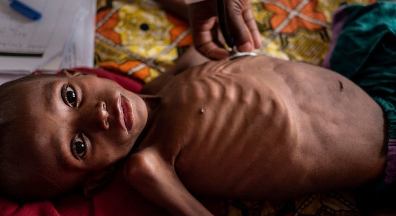 Na República Centro-Africana, milhões de crianças estão fora da escola, desnutridas e vulneráveis a doenças, ao abuso e à exploração.