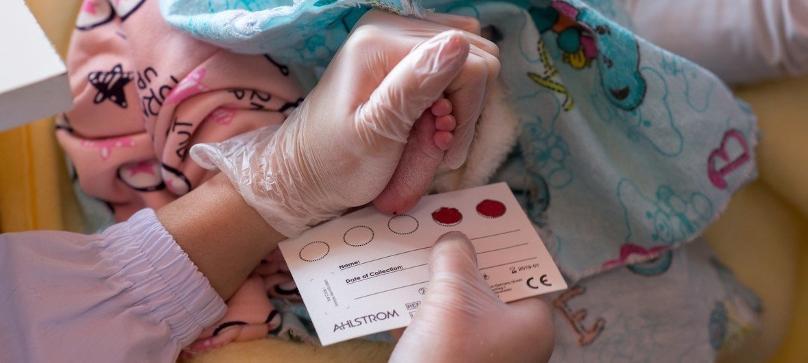 Un bebe recibe la prueba instantánea del VIH.