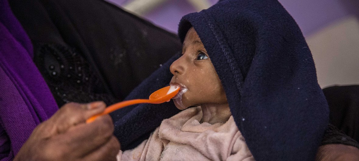Un bébé de deux mois souffrant de malnutrition sévère est nourri à Hajjah, au Yémen. La poursuite du conflit au Yémen pousse des millions de personnes au bord de la famine.