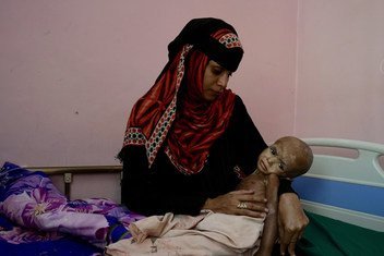Fawaz, que sufre desnutrición aguda, y su madre en el hospital de Adén, en Yemen, en noviembre de 2018.