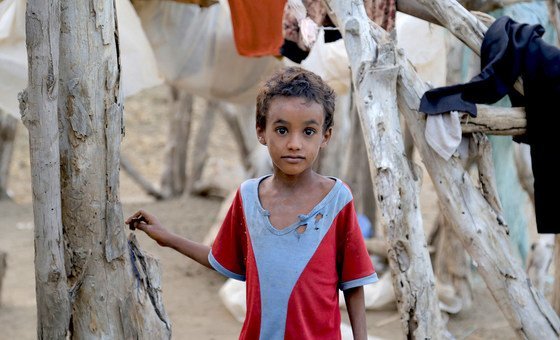 Millions of children across Yemen face serious threats due to malnutrition, in particular, and the lack of basic health services, in general. All these threats are caused by the ongoing war and hostilities in the country, especially in Hudaydah governorat