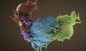 Estrutura 3D de células infetadas com HIV, a verde e azul, interagindo com células não infetadas, de cor castanha e roxa. 