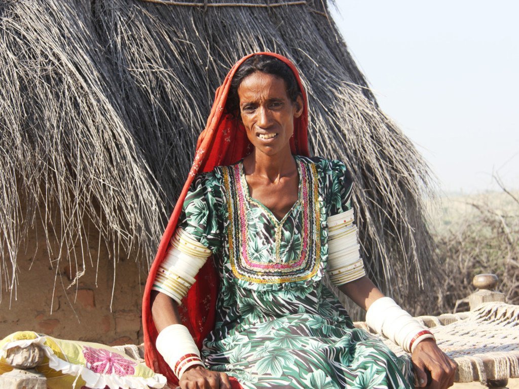 Cette femme tuberculeuse au Pakistan n’a pas été diagnostiquée pendant cinq ans parce qu’elle ne pouvait pas payer les frais de transport de 2 dollars pour se rendre de son village à l’hôpital civil de Tharparkar.