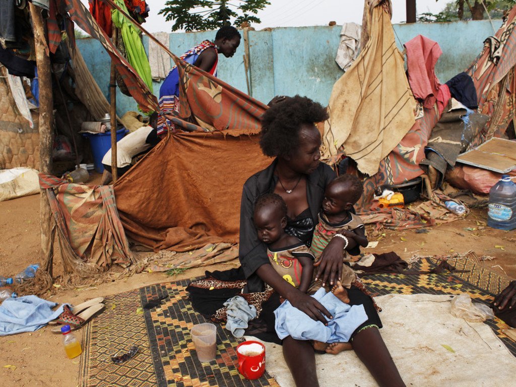 يعاني التوأم إليزابيث وماديلينا من سوء التغذية. جوبا، جنوب السودان (2018)