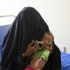 ملايين الأطفال بأنحاء اليمن يواجهون تهديدات صحية خطيرة بسبب سوء التغذية. (أرشيف عام 2018)