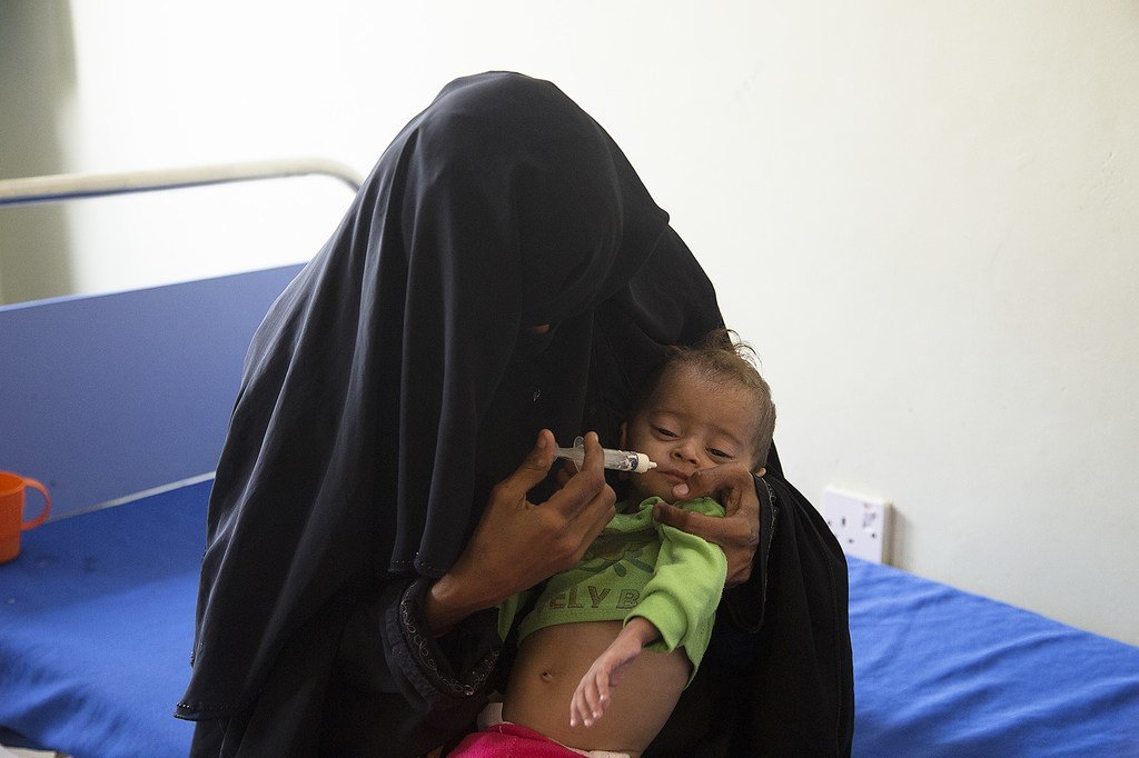 ملايين الأطفال بأنحاء اليمن يواجهون تهديدات صحية خطيرة بسبب سوء التغذية. (أرشيف عام 2018)