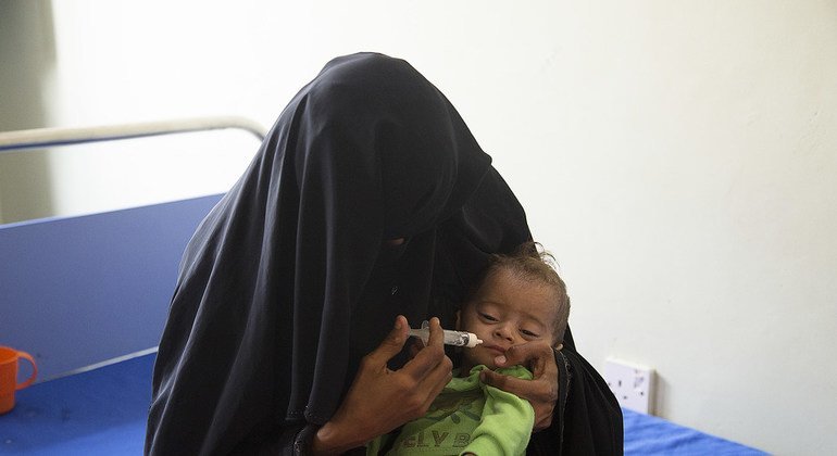 Millones de niños en Yemen se enfrentan a serios peligros debido a la malnutrición. Foto de archivo.