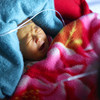 2011年10月，由儿基会与粮食署支持的朝鲜咸镜南道儿科医院，一名患有黄疸的新生儿。