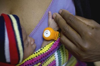 Baby in Papua New Guinea wears an orange hypothermia alert device at the neo natal unit in Mendi General Hospital in Southern Highlands Province to monitor its temperature.