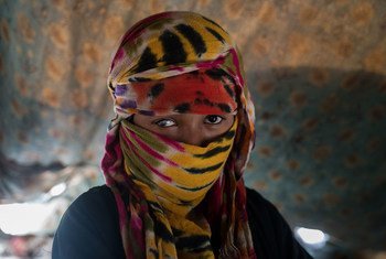 Jehan, 17, fled her hometown of Marib for the Khamir IDP settlement in Yemen at the beginning of the war in 2015.  She lost her eyesight in the right eye after her husband beat and abused her before abandoning her. She’s now living with other family members in a dilapidated shelter. (14 April 2017)