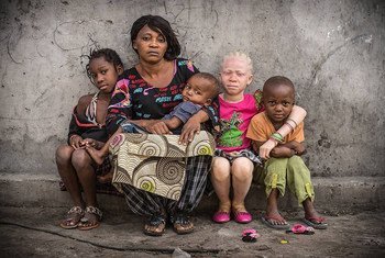 People affected by albinism are often visually impaired and need special protection against the sun. They often develop skin cancer and suffer from social stigmatization, according to UNICEF.