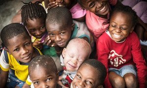 Albinism is a rare, non-contagious, genetically inherited condition present at birth. It is found in both sexes, regardless of ethnicity, in all countries of the world.