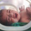 也门一个早产婴儿。