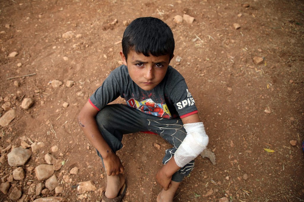 在叙利亚靠近土耳其边境的伊德利卜市以北45公里的一个临时营地中，一名受伤的叙利亚男孩正在地上休息。 （2019年6月图片）