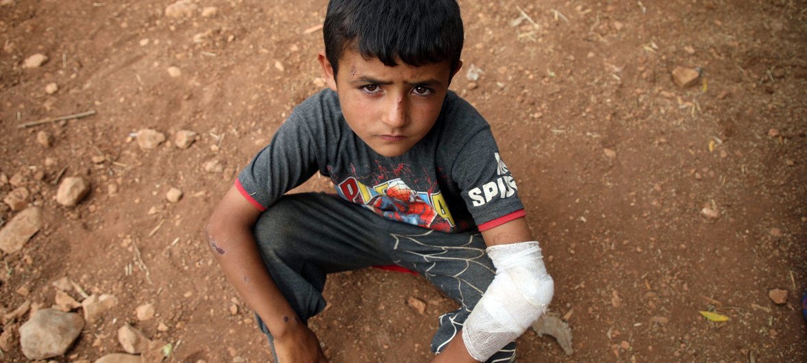 An injured boy rests on the ground of a makeshift camp in Syria's Aqrabat village, 45km north of Idlib City, near the Turkish border. (June 2019)